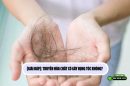 [Giải đáp]: Truyền hóa chất có gây rụng tóc không? 