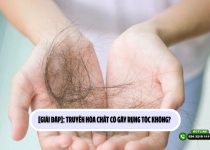 [Giải đáp]: Truyền hóa chất có gây rụng tóc không? 