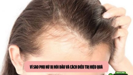 Vì sao phụ nữ bị hói đầu và cách điều trị hiệu quả 