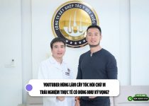 Youtuber Hùng Lâm cấy tóc hói chữ M: Trải nghiệm thực tế có đúng như kỳ vọng?