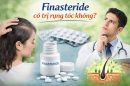 Finasteride có trị rụng tóc không? Câu trả lời có thể khiến nhiều người phải cân nhắc lại