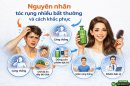 Nguyên nhân rụng tóc nhiều bất thường và cách khắc phục dứt điểm