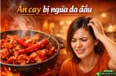Giải mã nguyên nhân ăn cay bị ngứa da đầu và cách khắc phục