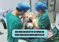 Biến chứng sau khi cấy tóc tại Thượng Hải: Tưởng chừng đổi đời nhưng nhận về hệ lụy