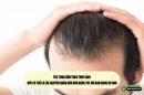 Tóc thưa dần theo thời gian – Đây có thể là các nguyên nhân dẫn đến rụng tóc mà bạn đang bỏ qua