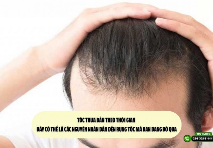 Tóc thưa dần theo thời gian – Đây có thể là các nguyên nhân dẫn đến rụng tóc mà bạn đang bỏ qua