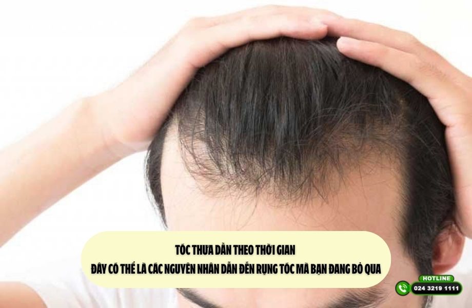 Tóc thưa dần theo thời gian – Đây có thể là các nguyên nhân dẫn đến rụng tóc mà bạn đang bỏ qua