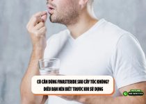 Có cần dùng Finasteride sau cấy tóc không? Điều bạn nên biết trước khi sử dụng