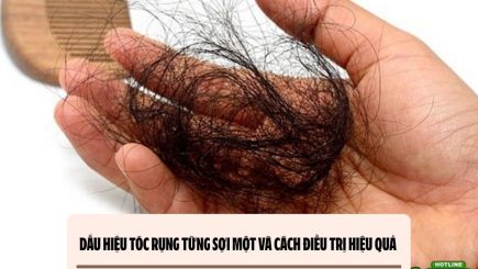 Dấu hiệu tóc rụng từng sợi một và cách điều trị hiệu quả 