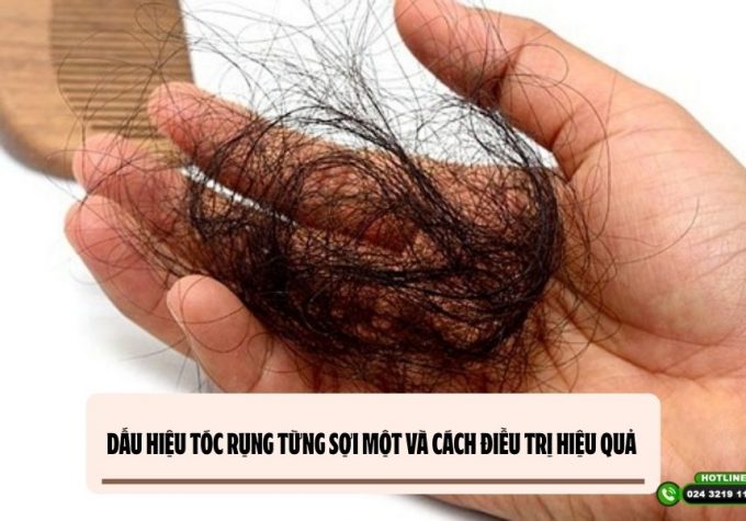Dấu hiệu tóc rụng từng sợi một và cách điều trị hiệu quả 