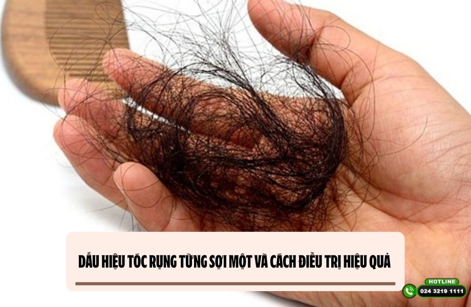 Dấu hiệu tóc rụng từng sợi một và cách điều trị hiệu quả 