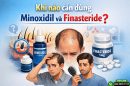 90% người rụng tóc không biết khi nào cần dùng Minoxidil và Finasteride?