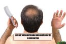 Điểm mặt những nguyên nhân chính dẫn đến rụng tóc và cách khắc phục