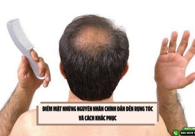 Điểm mặt những nguyên nhân chính dẫn đến rụng tóc và cách khắc phục 