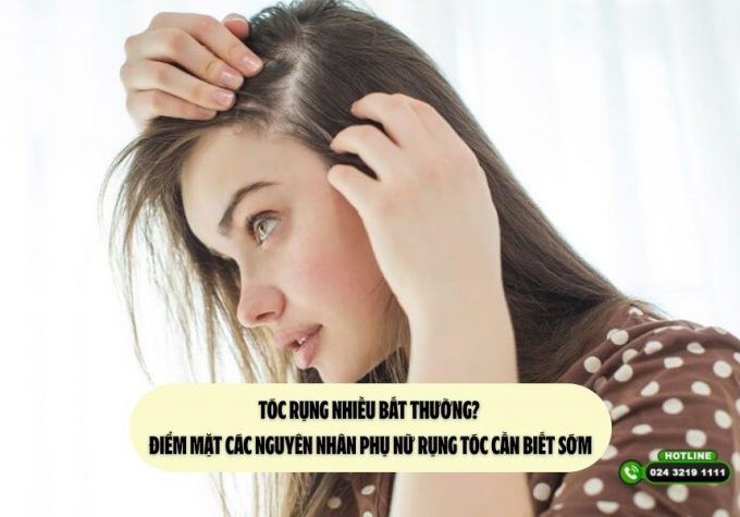 Tóc rụng nhiều bất thường? Điểm mặt các nguyên nhân phụ nữ rụng tóc cần biết sớm