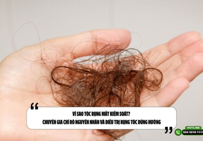 Vì sao tóc rụng mất kiểm soát? Chuyên gia chỉ rõ nguyên nhân và điều trị rụng tóc đúng hướng
