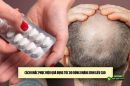 Cách khắc phục hiệu quả rụng tóc do dùng kháng sinh liều cao