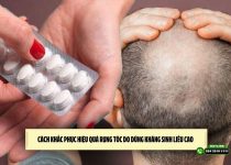 Cách khắc phục hiệu quả rụng tóc do dùng kháng sinh liều cao