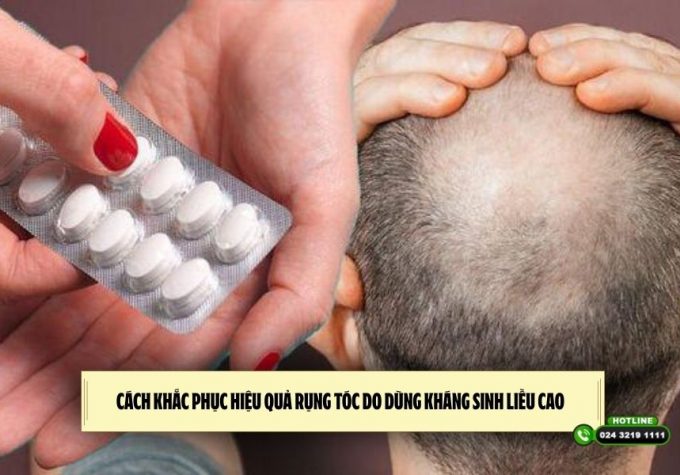 Cách khắc phục hiệu quả rụng tóc do dùng kháng sinh liều cao