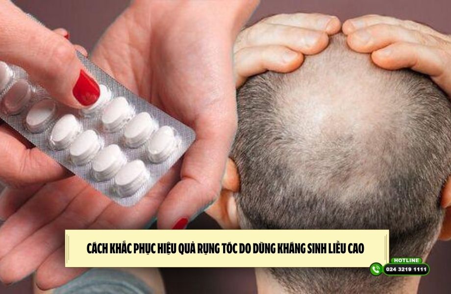 Cách khắc phục hiệu quả rụng tóc do dùng kháng sinh liều cao