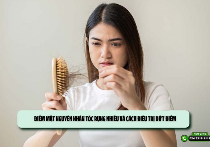Điểm mặt nguyên nhân tóc rụng nhiều và cách điều trị dứt điểm
