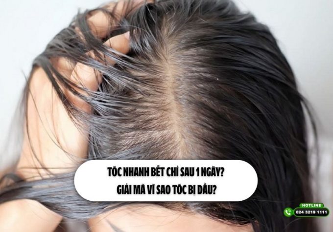 Tóc nhanh bết chỉ sau 1 ngày? Giải mã vì sao tóc bị dầu?