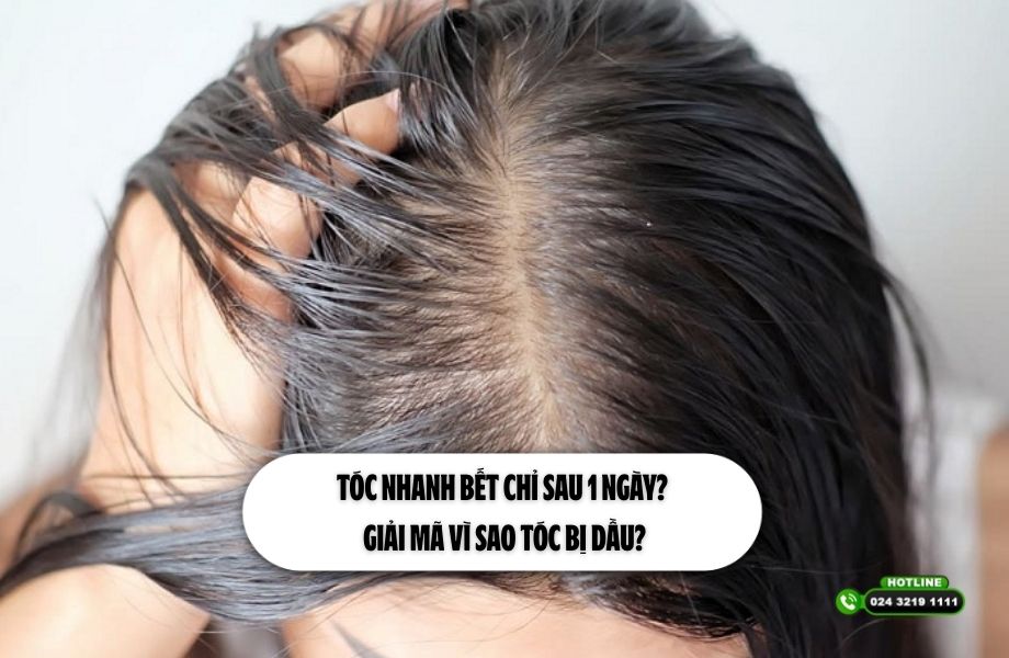 Tóc nhanh bết chỉ sau 1 ngày? Giải mã vì sao tóc bị dầu?