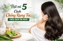 Bật mí 5 cách chống rụng tóc hiệu quả tại nhà ai cũng làm được