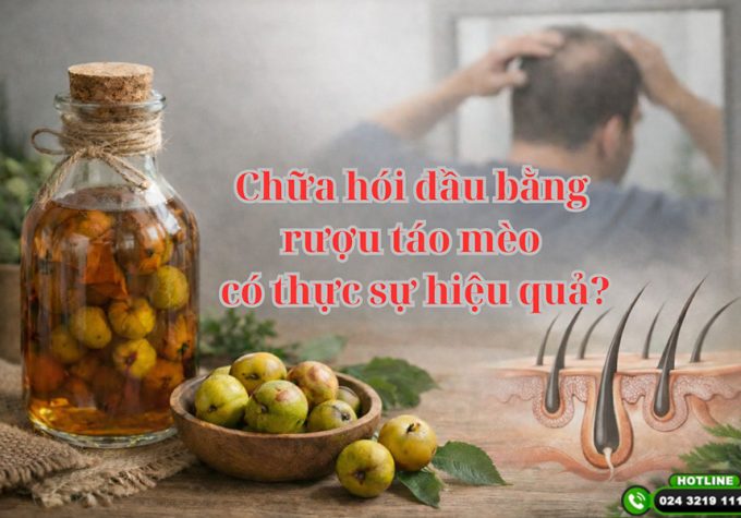 Chữa hói đầu bằng rượu táo mèo có thực sự hiệu quả như nhiều người truyền tai?