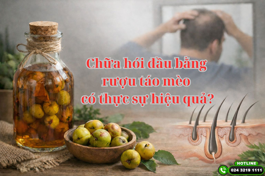Chữa hói đầu bằng rượu táo mèo có thực sự hiệu quả như nhiều người truyền tai?