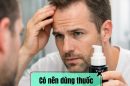Có nên dùng thuốc trị hói 2 bên trán không? Điều cần biết trước khi sử dụng