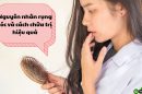 Rụng tóc nhiều bất thường – Đâu là nguyên nhân gây rụng tóc và cách chữa trị hiệu quả?