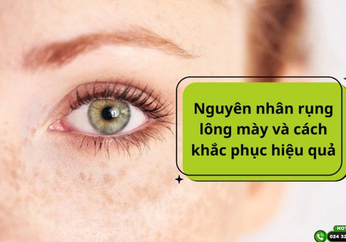 Nguyên nhân rụng lông mày và cách khắc phục hiệu quả