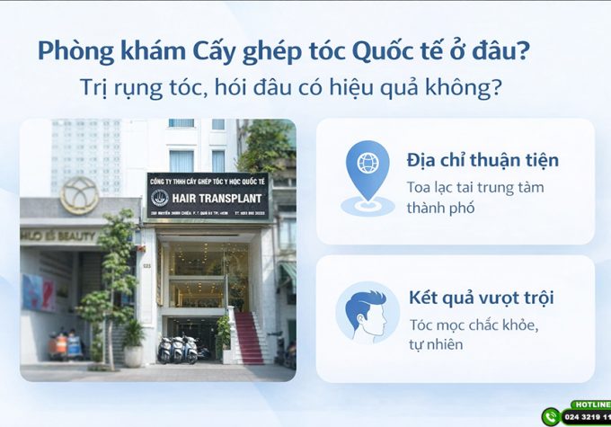 Phòng khám Cấy ghép tóc Quốc tế ở đâu? Trị rụng tóc, hói đầu có hiệu quả không?