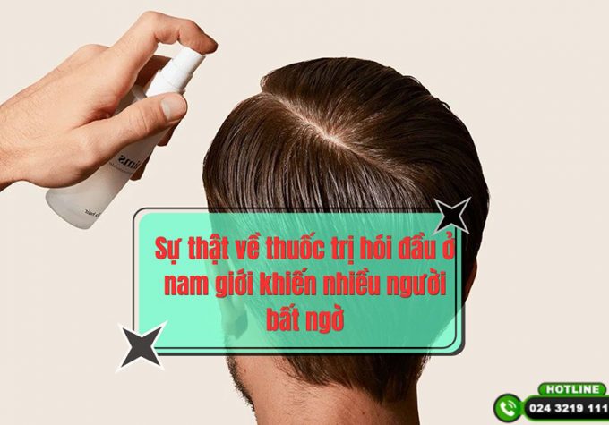 Sự thật về thuốc trị hói đầu ở nam giới khiến nhiều người bất ngờ