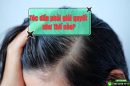 [Chia sẻ bí quyết] : Tóc dầu phải giải quyết như thế nào?