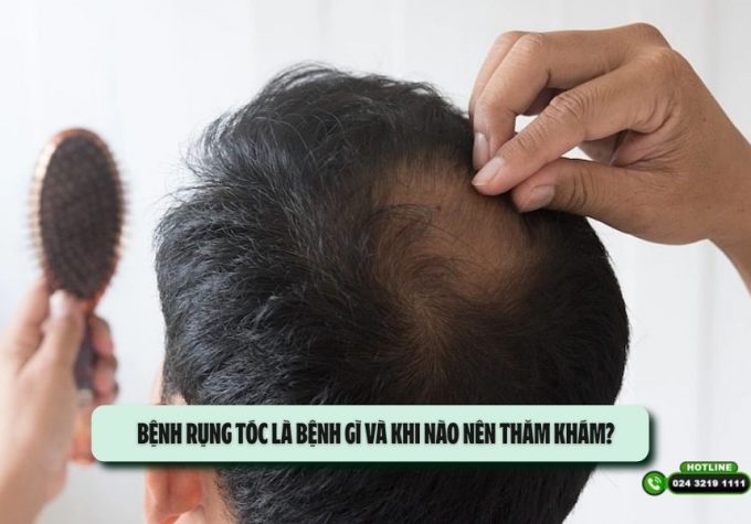 Bệnh rụng tóc là bệnh gì và khi nào nên thăm khám?
