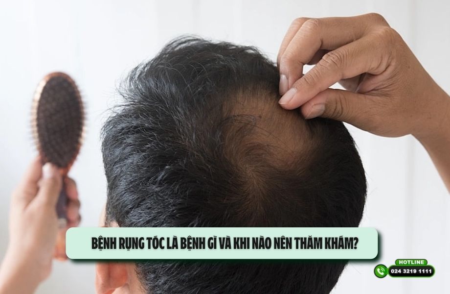 Bệnh rụng tóc là bệnh gì và khi nào nên thăm khám?