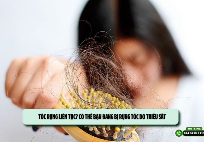 Tóc rụng liên tục? Có thể bạn đang bị rụng tóc do thiếu sắt