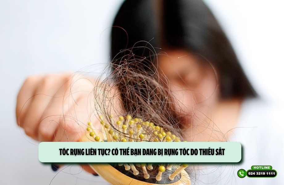 Tóc rụng liên tục? Có thể bạn đang bị rụng tóc do thiếu sắt