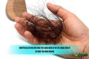 Chuyên gia chỉ rõ biểu hiện tóc rụng bệnh lý và tóc rụng sinh lý để điều trị đúng hướng