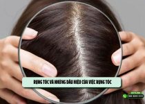 Rụng tóc và những dấu hiệu của việc rụng tóc