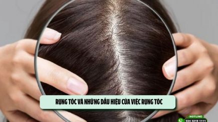 Rụng tóc và những dấu hiệu của việc rụng tóc