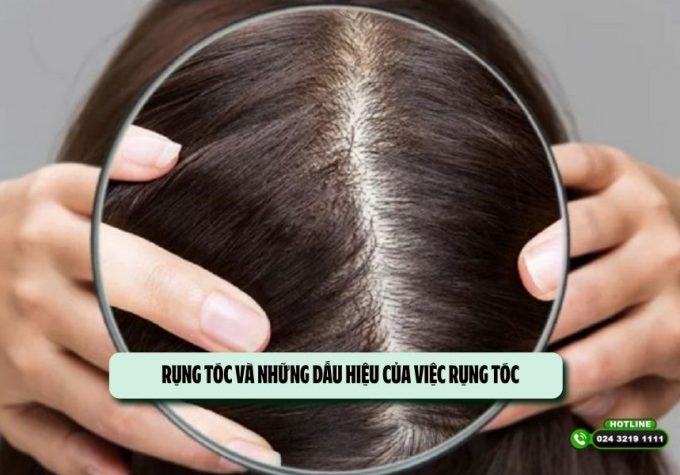 Rụng tóc và những dấu hiệu của việc rụng tóc