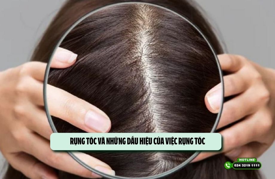Rụng tóc và những dấu hiệu của việc rụng tóc