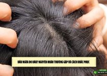 Đầu ngứa do đâu? Nguyên nhân thường gặp và cách khắc phục
