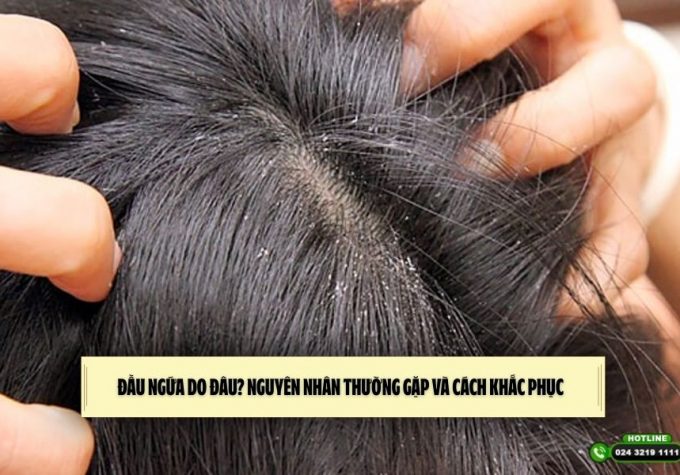 Đầu ngứa do đâu? Nguyên nhân thường gặp và cách khắc phục