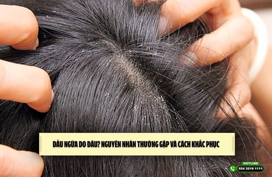 Đầu ngứa do đâu? Nguyên nhân thường gặp và cách khắc phục