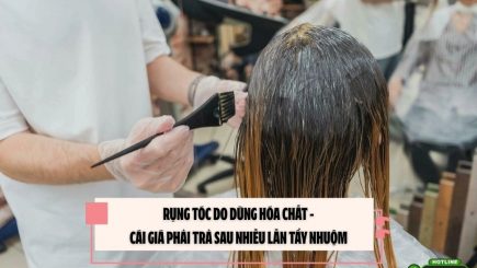Rụng tóc do dùng hóa chất - Cái giá phải trả sau nhiều lần tẩy nhuộm