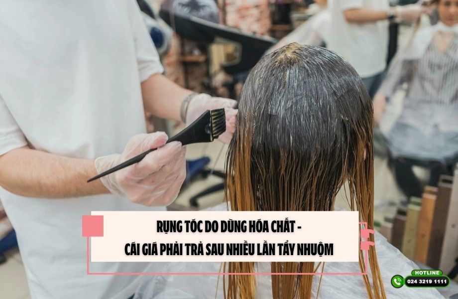 Rụng tóc do dùng hóa chất – Cái giá phải trả sau nhiều lần tẩy nhuộm
